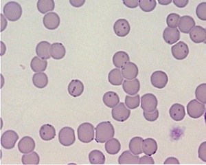 parasitic blood infection in cats
